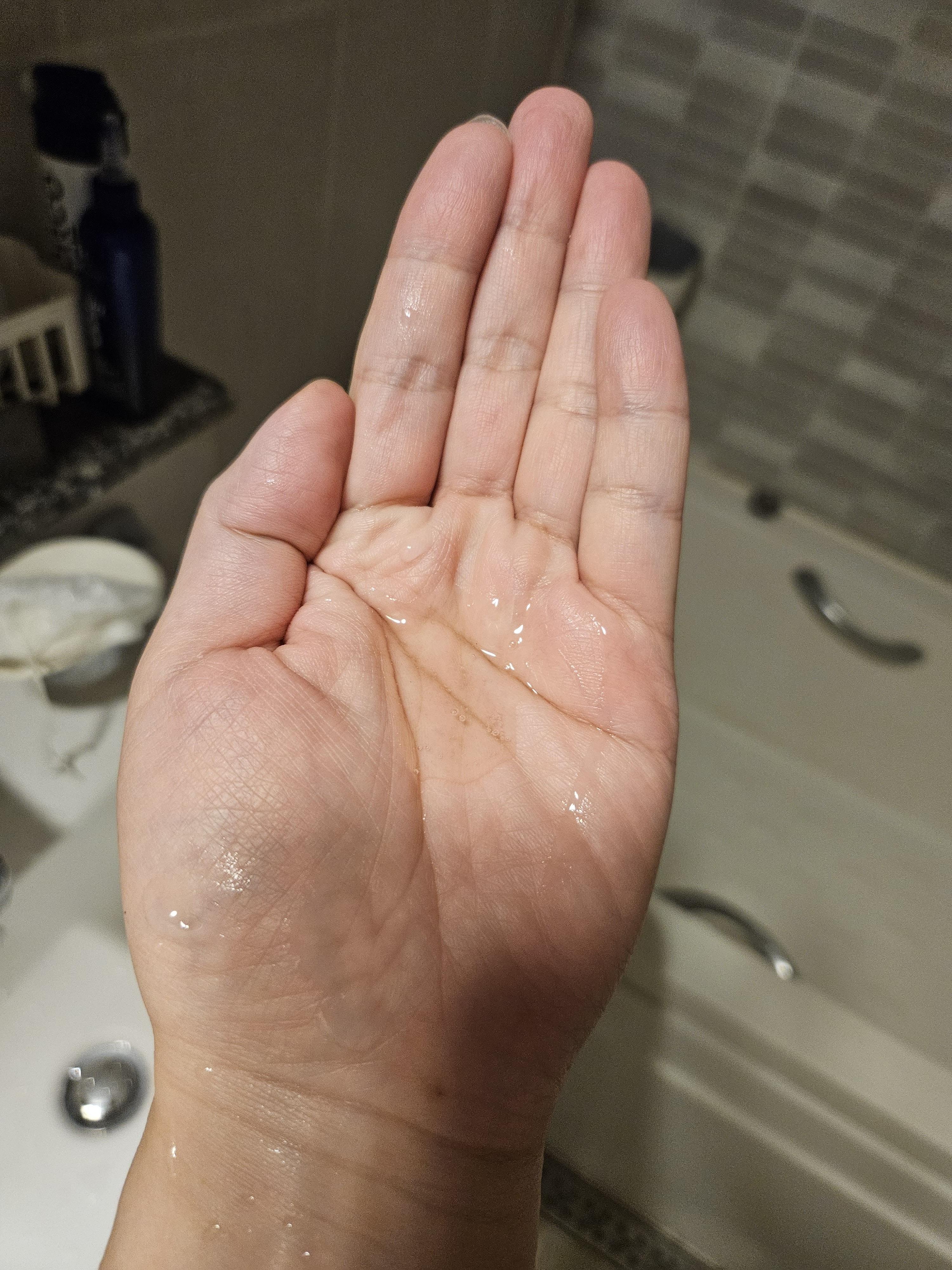 지루성 피부염 및 비듬 치료 샴푸 덴트로프쿨액 1회 사용량