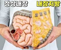 내장지방비교