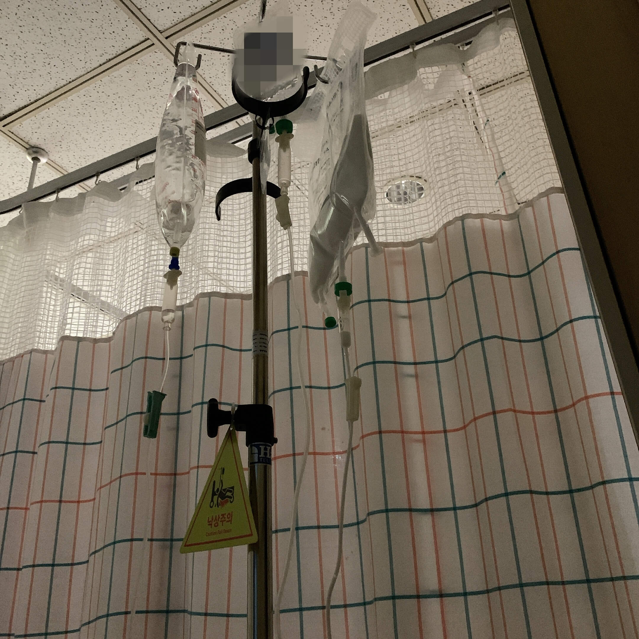 위 용종 제거수술 입원 대학병원 위 용종 제거 입원 후기