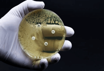 연쇄상구균 독성