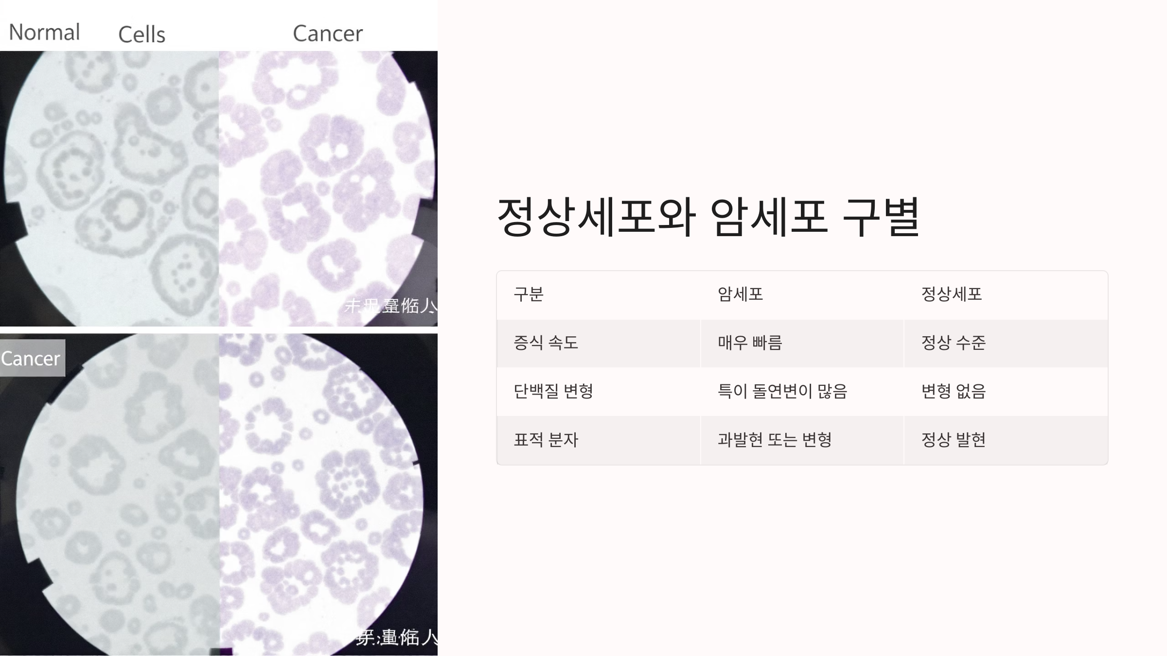 정상세포와 암세포 구별