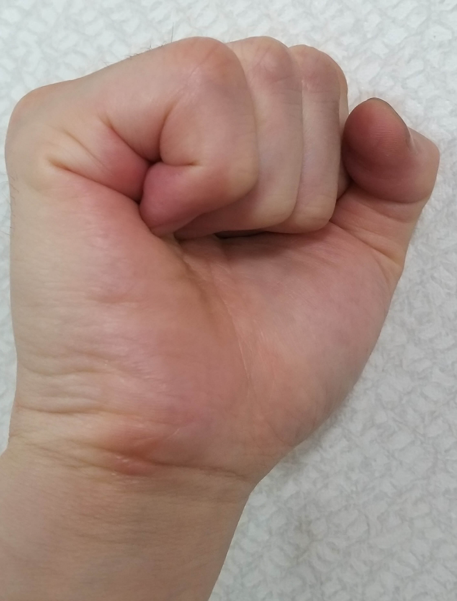 재활4주차구부림정도좋음