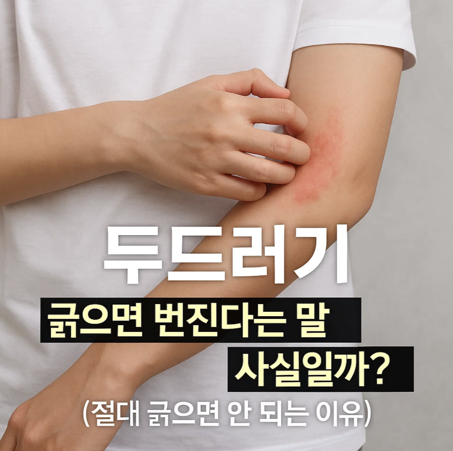 두드러기, 긁으면 번진다는 말 사실일까? (절대 긁으면 안 되는 이유)