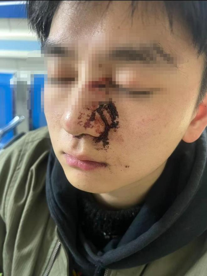 개목줄 문제로 충돌”… 重庆충칭 무단견주 폭행 사건, 2심에서도 징역 1년 확정