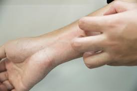 온몸이 가려운 증상