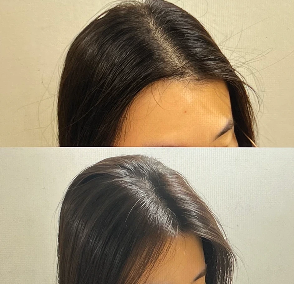 트리코닉스-샴푸-후기-솔직-사용-알리기-위해-찍은-전-후-사진