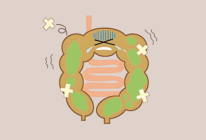 염증이-있는-장의-모습