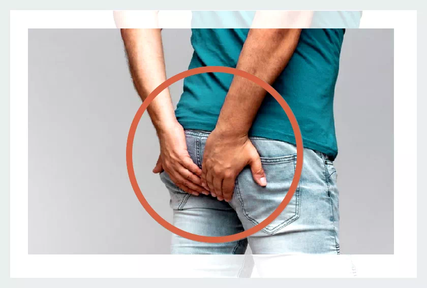 항문거근증후군