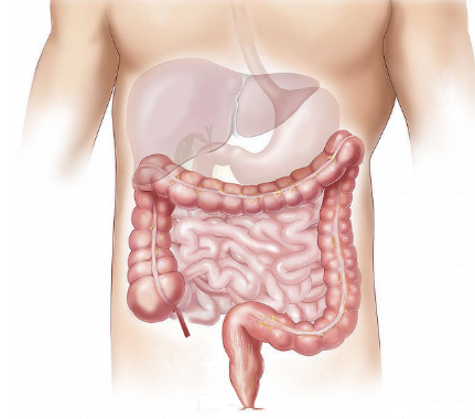 대장과 소장 모형