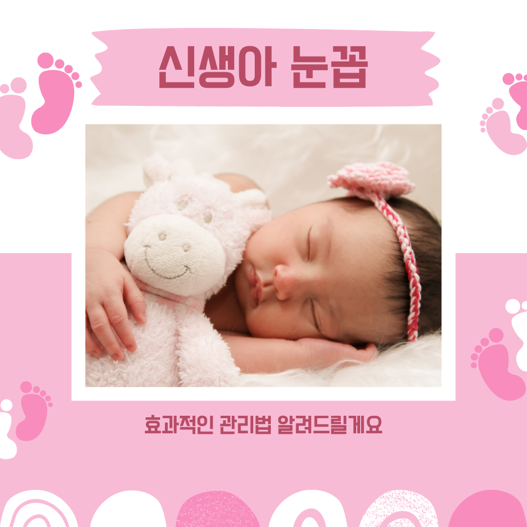 신생아 눈꼽, 걱정하지 마세요! 효과적인 관리법 알려드릴게요.