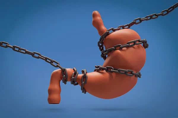 초기 증상 없는 위암