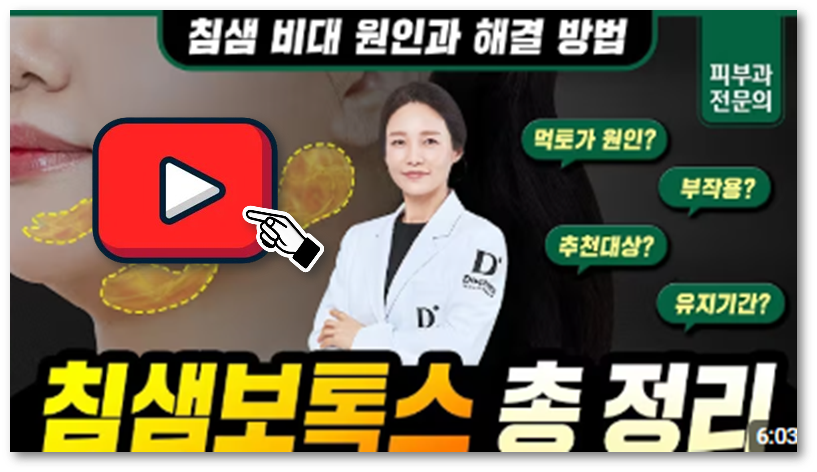 침샘보톡스