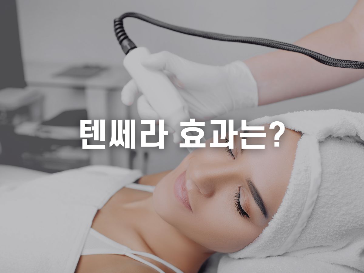 텐쎄라 가격