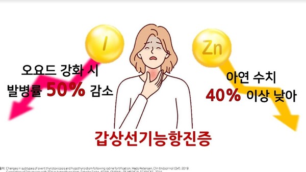 갑상선 항진증