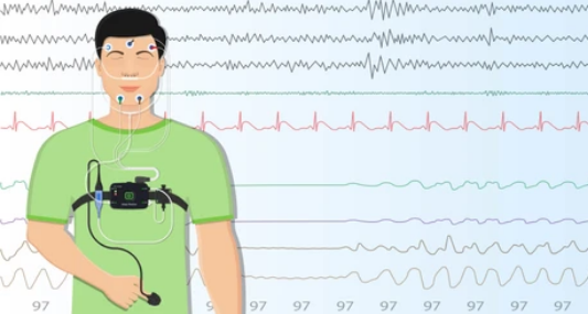 수면 무호흡증 검사방법