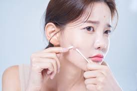 겨울철 피부관리 꿀팁 7가지 &ndash; 집에서도 가능한 보습 홈케어 루틴