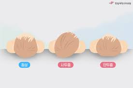 단두증