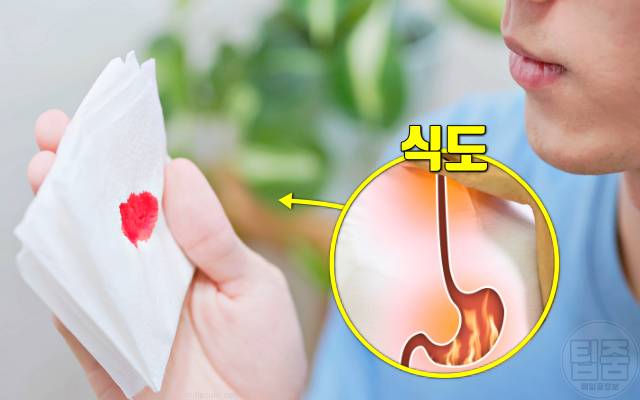 간암 증상 생로병사의비밀 객혈 피를 토하는 증세