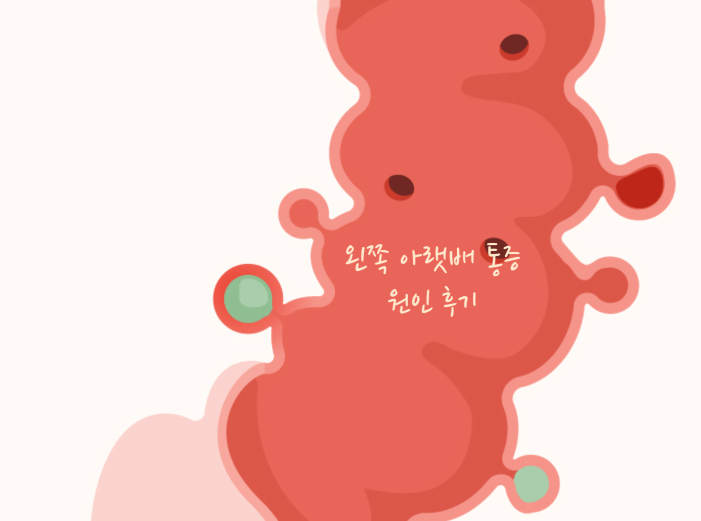 왼쪽 아랫배 통증