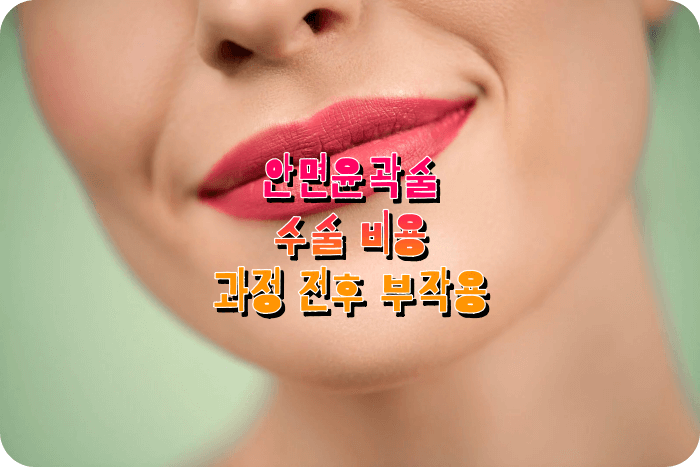 안면윤곽술 안면거상술