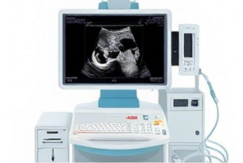 복부초음파 실비보험