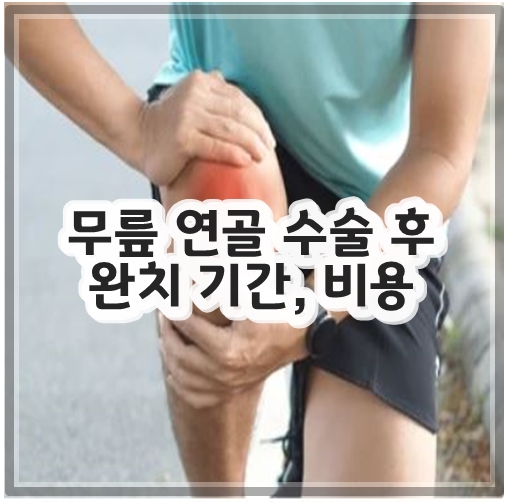 무릎 연골 수술 후 완치 기간, 비용