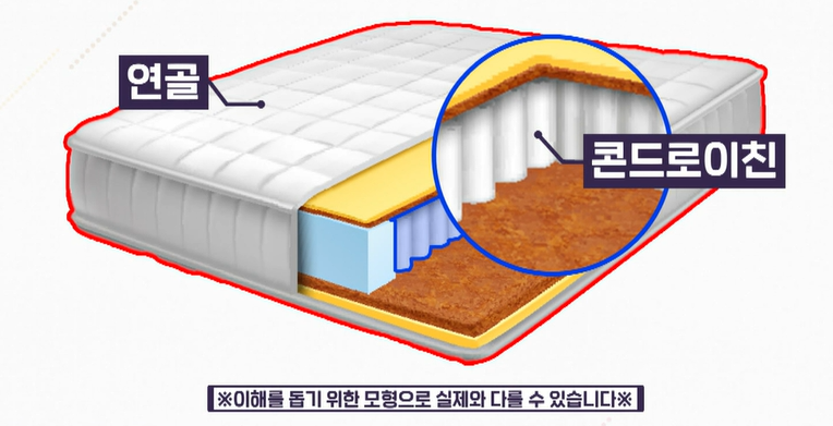 콘드로이친