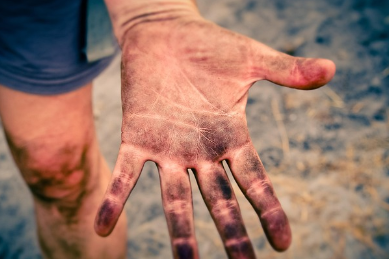 핫팩 사용 주의