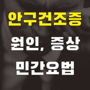 안구건조증 민간요법 원인 증상 치료