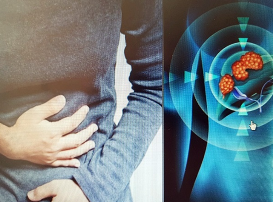 간경화 증상으로 피부 가려움증, 복부팽창 등이 있습니다