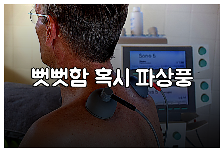 뻣뻣함 혹시 파상풍