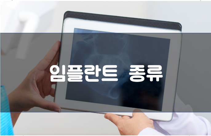 임플란트종류