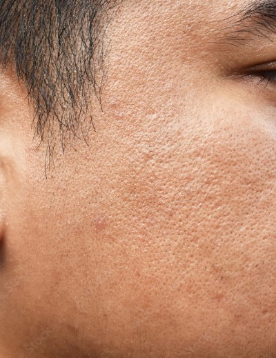 모공 줄이는 방법 및 남자 피부 모공 관리 10가지 수칙