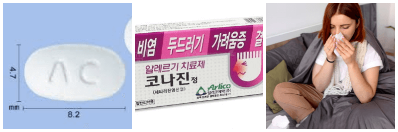코나진정, 알레르기 비염 사진