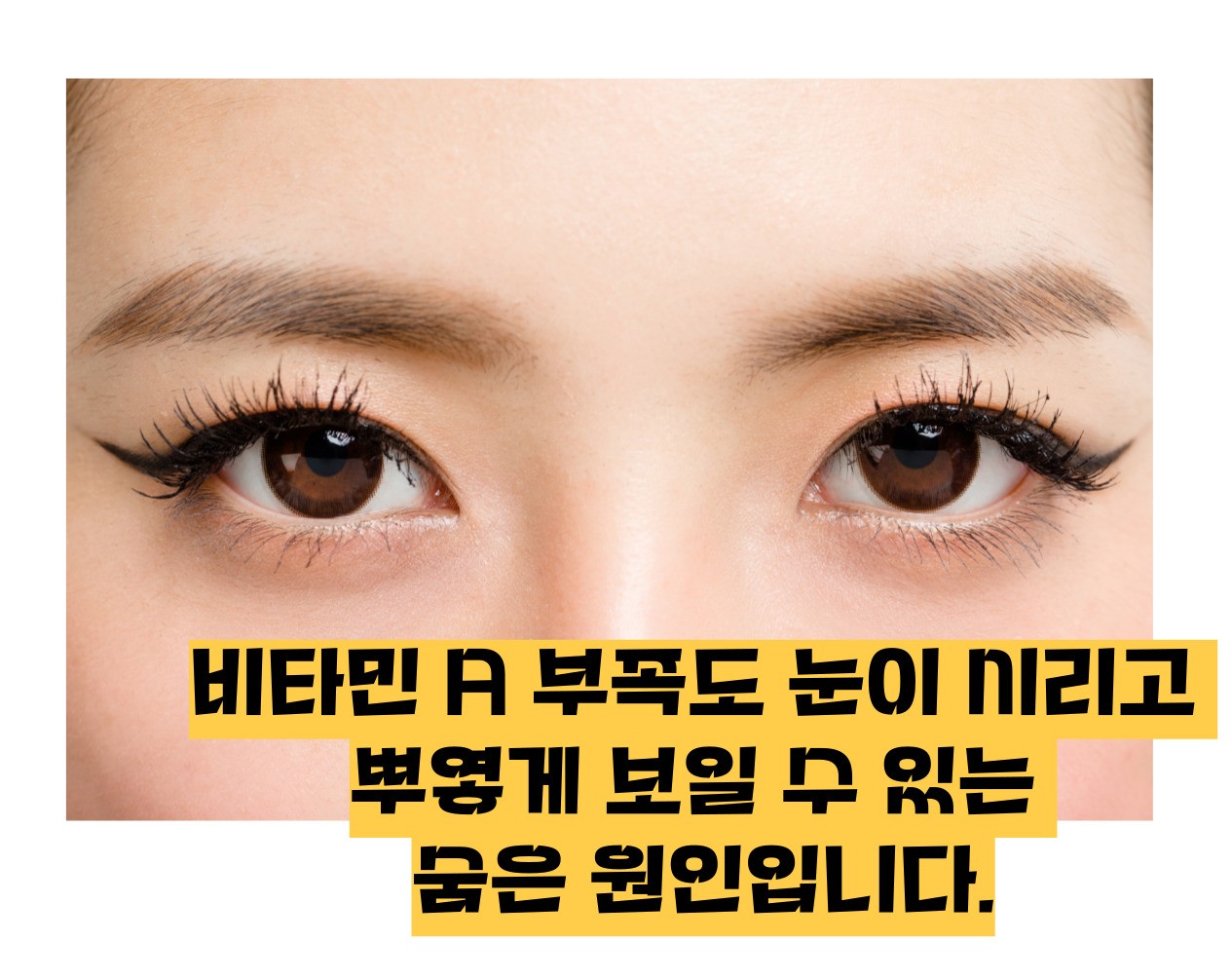 눈이 시리고 눈물이 나는 이유