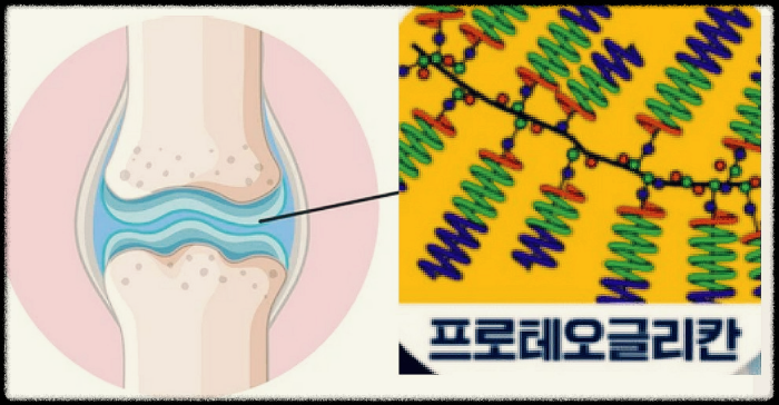 연골-프로테오글리칸-사진