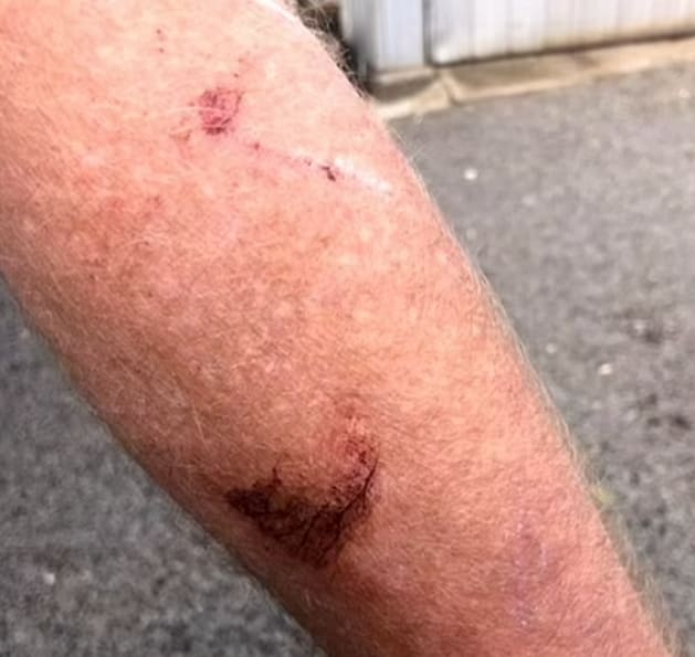 불량 캥거루와 잔혹한 난투극 벌인 남자 VIDEO: Wild moment man battles kangaroo before pinning it to the ground