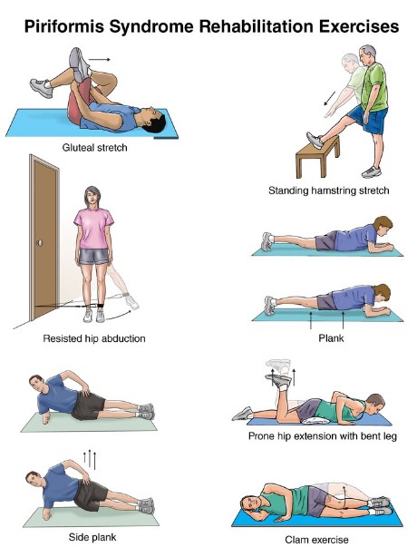 이상근 증후군 스트레칭