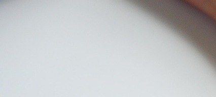 류마티스관절염