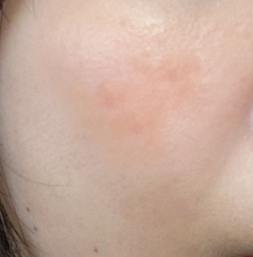 세로파민 유산균 사용자 효과