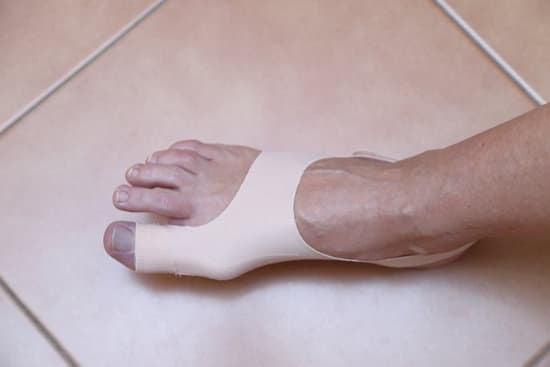 무지외반증 수술 후 관리와 주의사항