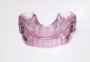 수면 무호흡증 치료 방법: 구강장치