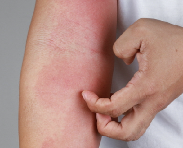 몸이 가려운 이유 13가지 총정리 섬네일