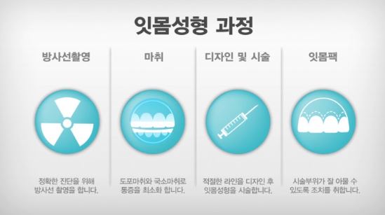 잇몸시술 과정 사진