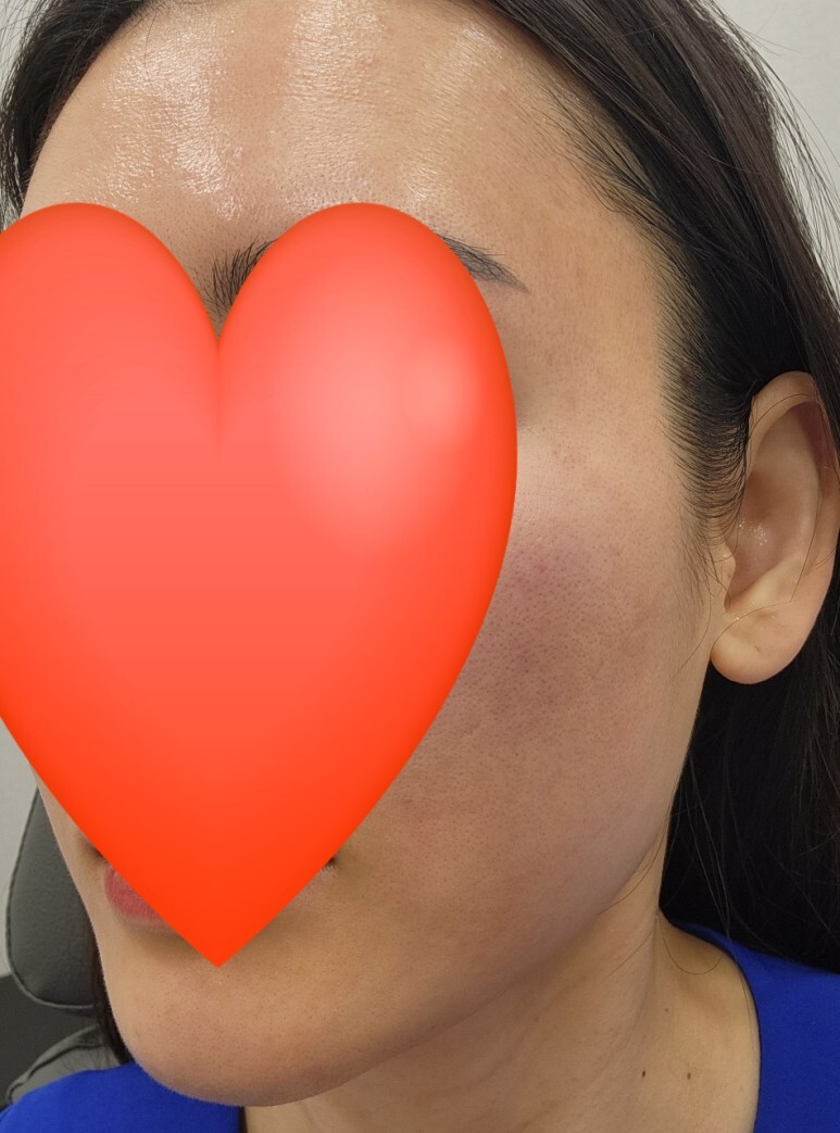 아이올리지오 후기