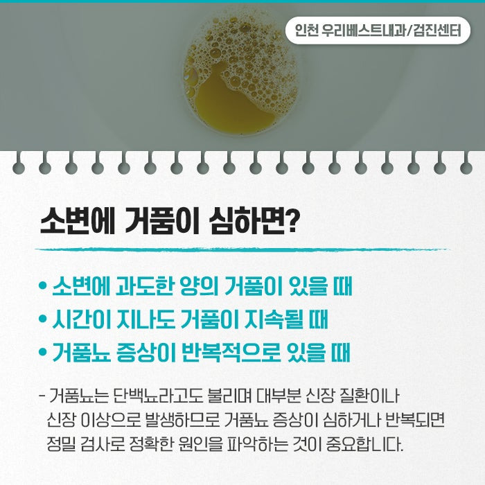 소변에 거품이 나는 이유 증상 해결책