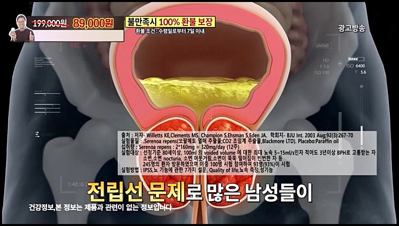 이만기 쏘팔메토 효능 부작용 종합정리