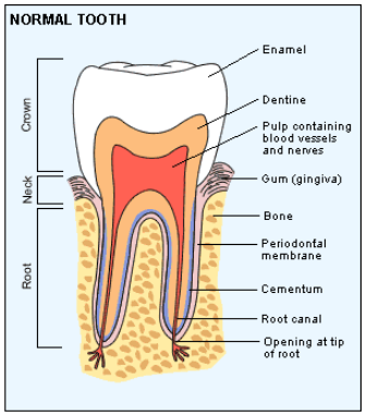 치과 신경치료와 크라운치료