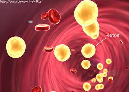 콜레스테롤 낮추는 방법 10가지