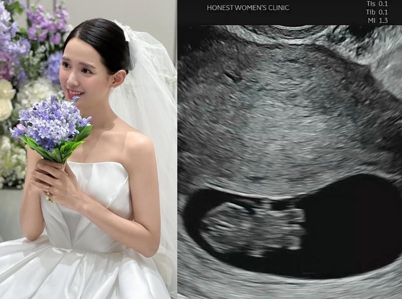 남보라 만삭 D라인 화보